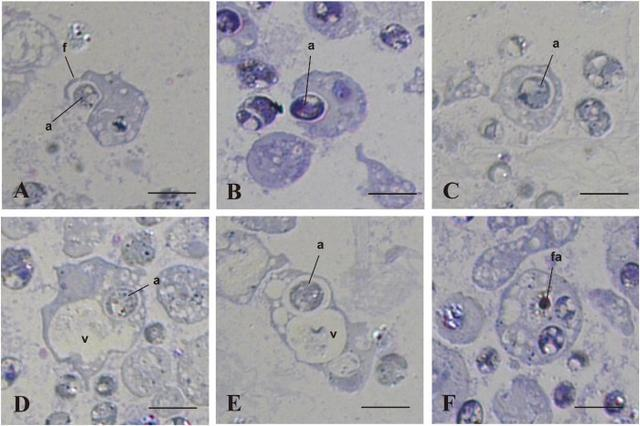 珊瑚細胞和微藻共生